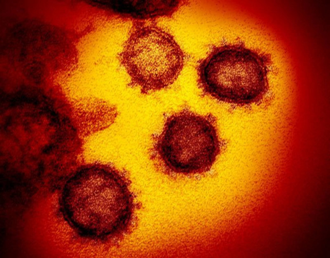 Hình ảnh chủng virus corona mới dưới kính hiển vi.