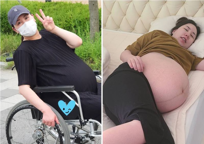 Nữ diễn viên hài người Hàn Quốc Hwang Shin-young hiện đang chuẩn bị cho việc sinh 3. Cô đã tăng 30 kg trong thai kỳ và hiện phải ngồi xe lăn khi đi lại.