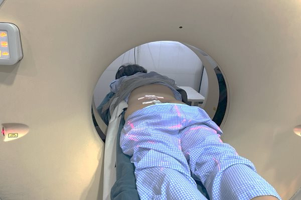 Bệnh nhân V.N.T. (47 tuổi, ngụ TP.HCM) được tiến hành chụp CT Scan vùng bụng chậu-Ảnh: BVCC