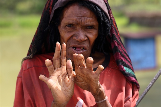 Người phụ nữ Danai này đã tự chặt tới 6 ngón tay để tưởng nhớ người chồng và các con đã chết