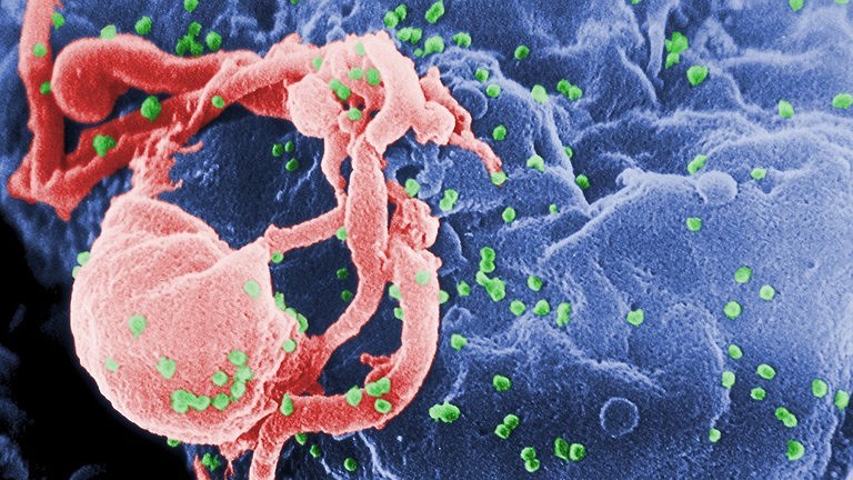 Trên thế giới đã có 3 bệnh nhân được chữa khỏi HIV. Ảnh: RT    