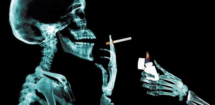 Những người hút thuốc lá có nguy cơ bị mắc ung thư phổi cao hơn với người bình thường.    