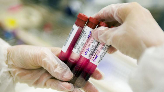 Chỉ cần lấy máu một lần duy nhất, các bác sĩ có thể tầm soát cùng lúc 8 loại ung thư cho bệnh nhân - ảnh: LOS ANGELES TIMES