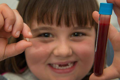 Vào năm 2012, một cô bé người Anh tên Becca Graham đã trở thành em bé đầu tiên ở Anh lưu trữ tế bào gốc từ răng sữa.