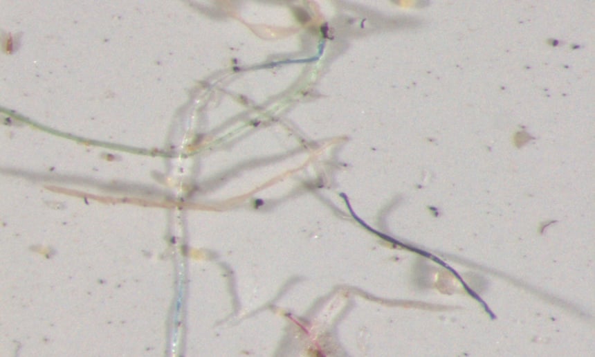 Các mẫu nước mưa được thu thập trên khắp Colorado được phân tích dưới kính hiển vi cho thấy nhiều sợi nhựa