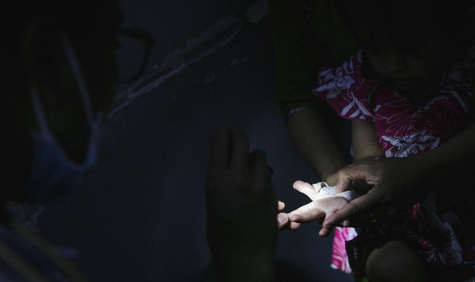Bác sĩ phải dùng đèn pin để thăm khám tìm các triệu chứng chân tay miệng ở trẻ