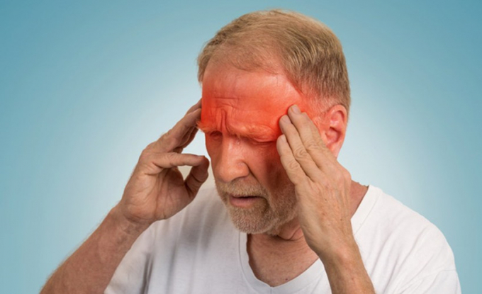Một cơn đau nửa đầu bất chợt, dữ dội: Trong cơn đột quỵ, máu lưu thông đến não hoặc bị chặn hoặc bị ngắt hoàn toàn do một sự gián đoạn trong mạch máu. Điều này có thể gây rách hoặc hủy hoại mạch máu, dẫn đến một cơn đau nửa đầu hoặc đau đầu đột ngột.