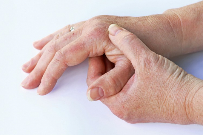 Ngón tay đau nhức: Ngón tay bất chợt dày lên và dễ đau nhức có thể là dấu hiệu của ung thư phổi. Khi khối u phổi phát triển, chúng giải phóng một số hóa chất vào máu kích thích sự phát triển mô dưới móng tay và trong đầu ngón tay, gây đau đớn. Nếu bạn gặp phải tình trạng dày và sưng trên ngón tay, nên tới bác sĩ để kiểm tra sớm.