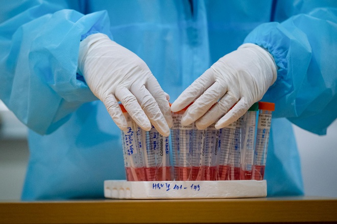 Bệnh nhân 91 sẽ được ghép phổi khi khẳng định sạch virus và điều trị nhiễm trùng tích cực. Ảnh: Phạm Thắng.