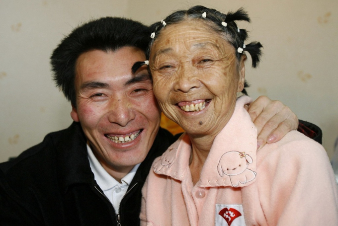 Chuyện tình cặp Trung Quốc Li Yucheng (50 tuổi) và bà Ma Yuqin (82 tuổi) luôn nhận được nhiều sự quan tâm, tò mò. Ảnh: Sina.