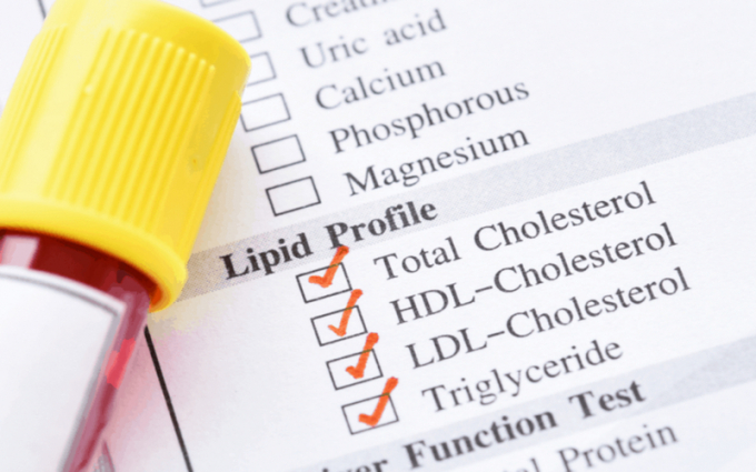 Xét nghiệm mỡ máu: Nồng độ cholesterol và triglycerid có thể ảnh hưởng lớn đến sức khỏe có thể gây ra đột quỵ hoặc trụy tim ở người cao tuổi.
