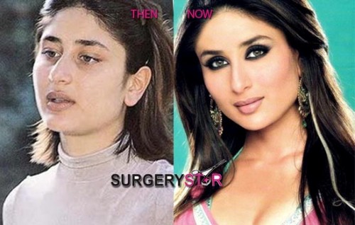 Ngôi sao Kareena Kapoor của Ấn Độ đã từng thực hiện nhiều ca phẫu thuật thẩm mỹ tại quê hương mình 