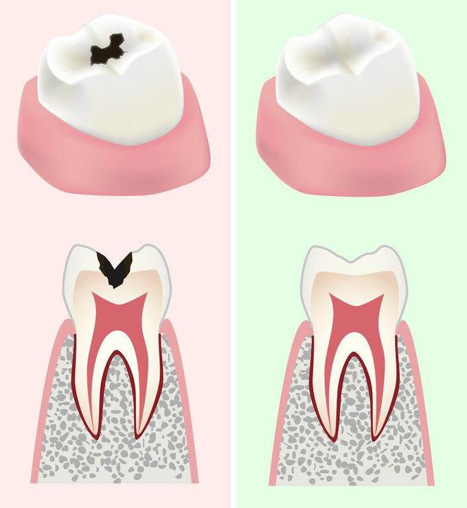 Sức khỏe răng miệng sẽ được cải thiện (Ảnh minh họa)