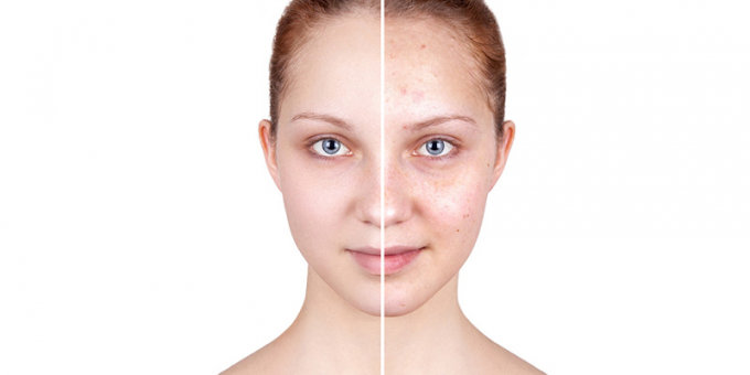 Ở độ tuổi ngoài 30, da bắt đầu xuất hiện các nế nhăn mờ và thay đổi màu da do suy giảm collagen (Ảnh: Skinbetter Science)