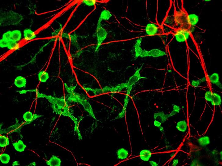  Microglia - các tế bào của hệ thần kinh có chức năng chống nhiễm trùng và khắc phục những tổn thương não khi chúng ta ngủ - Ảnh: Naked Science