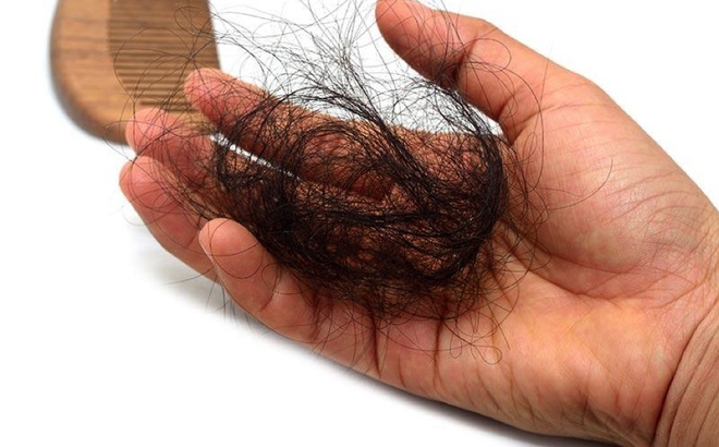 Bạn có thể tự chữa rụng tóc tại nhà hiệu quả