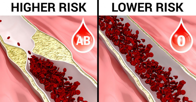 Lợi ích sức khỏe: Những người nhóm máu O có nguy cơ mắc bệnh tim mạch vành thấp nhất so với những người có nhóm máu A, B và AB. Hơn nữa, những người có nhóm máu O có nguy cơ phát triển các bệnh tuần hoàn và rối loạn nhận thức thấp hơn.
