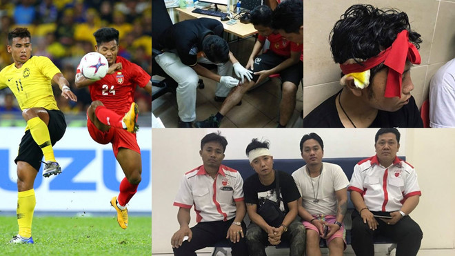 Các CĐV Myanmar bị tấn công sau thất bại của đội tuyển trước Malaysia. Ảnh: Fox Sports Asia.
