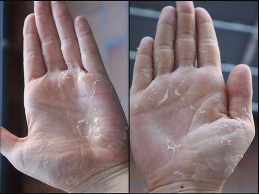  Thận trọng khi dùng các loại nước rửa tay khô không rõ thành phần, nguồn gốc tránh gây hại sức khỏe. Ảnh minh họa