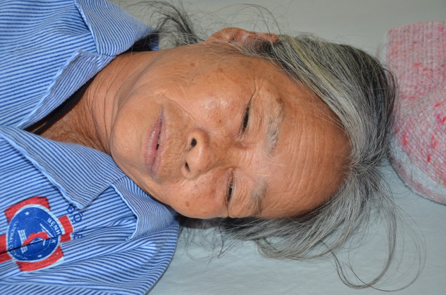  Bà Nguyễn Thị Sánh, năm nay 69 tuổi mắc căn bệnh ung thư vú đã đến giai đoạn di căn