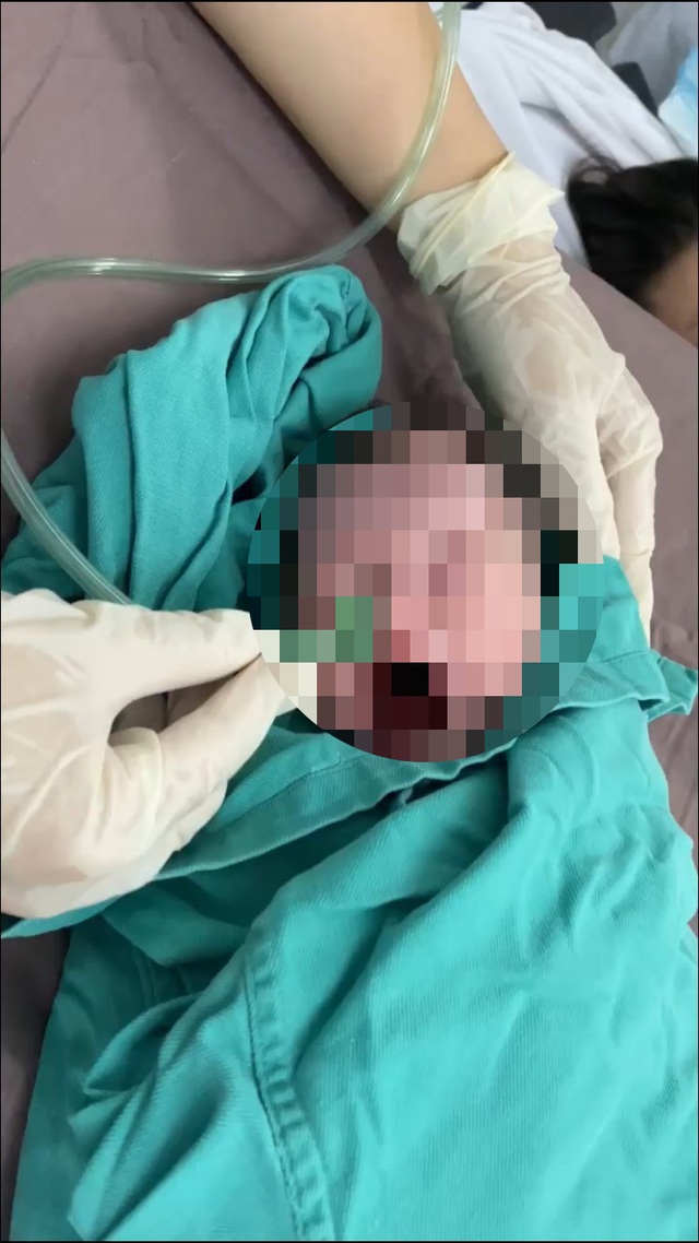  Đứa trẻ sinh non ở tuần 34 thai kì được chuyển khẩn cấp sang chăm sóc ở khoa Nhi bệnh viện Bạch Mai