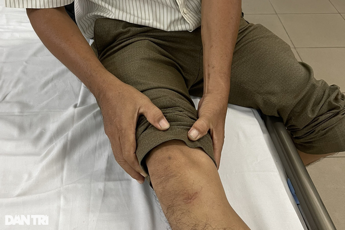  Một trường hợp bị chấn thương chân, đang được chụp X-quang kiểm tra (Ảnh: CTV).