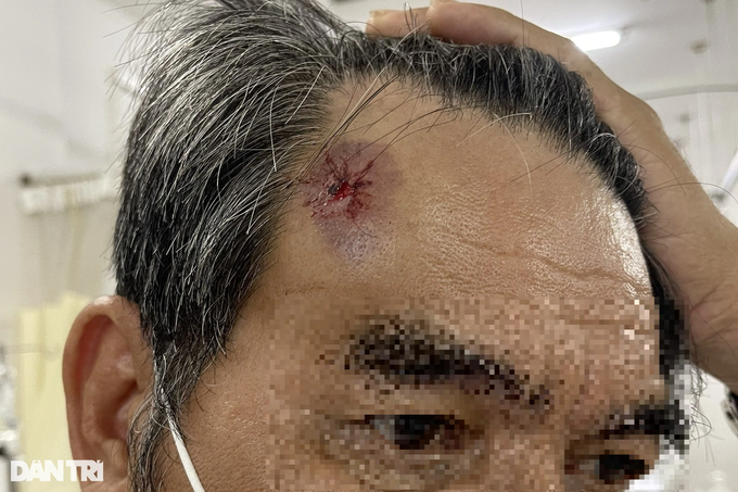  Một nạn nhân bị chấn thương vùng đầu (Ảnh: CTV).