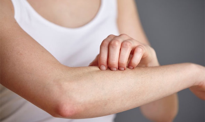 Ngứa da có thể là dấu hiệu cảnh báo ung thư đường mật (Ảnh minh họa: Getty).