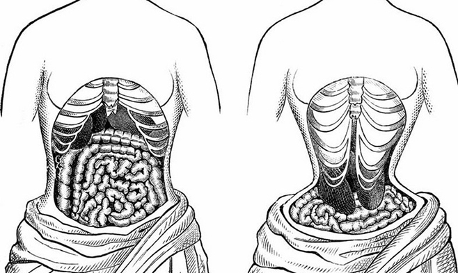  Mô phỏng về sự biến đổi cơ thể khi dùng đai nịt bụng. Ảnh: Vnexpress 