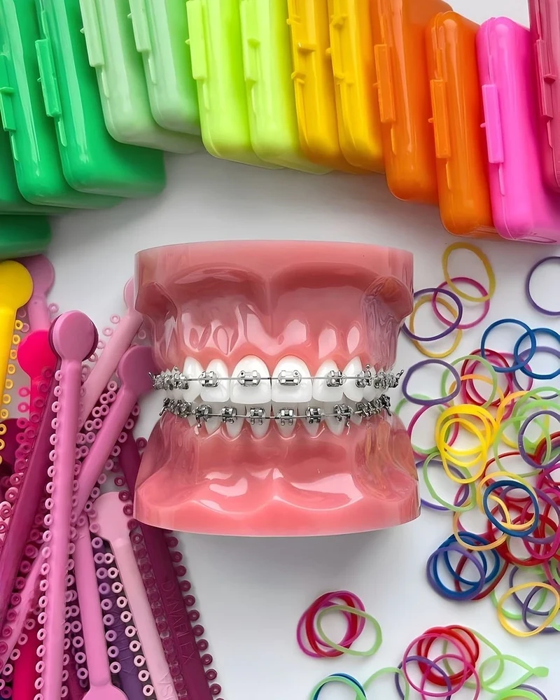  Các bác sĩ nha khoa cho biết việc sử dụng niềng răng thời trang có thể tiềm ẩn nhiều nguy hiểm. Ảnh minh họa: @vadorned/IG.