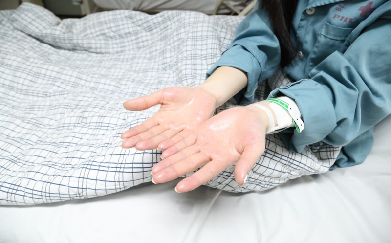  Bàn tay ướt đẫm mồ hôi của người bệnh Đ.T.T.M trước phẫu thuật. Ảnh BVCC