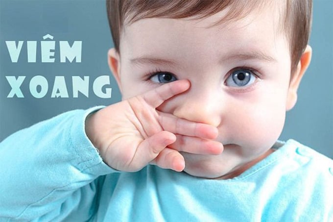  Trẻ bị sổ mũi, hắt hơi kéo dài có thể dẫn đến viêm xoang