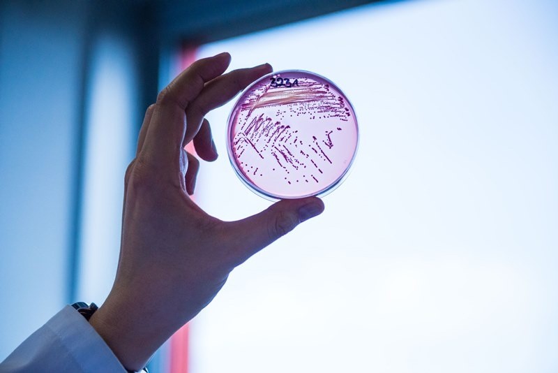 Một mẫu vi khuẩn E. coli. Ảnh: Đại học Giessen (Đức) 