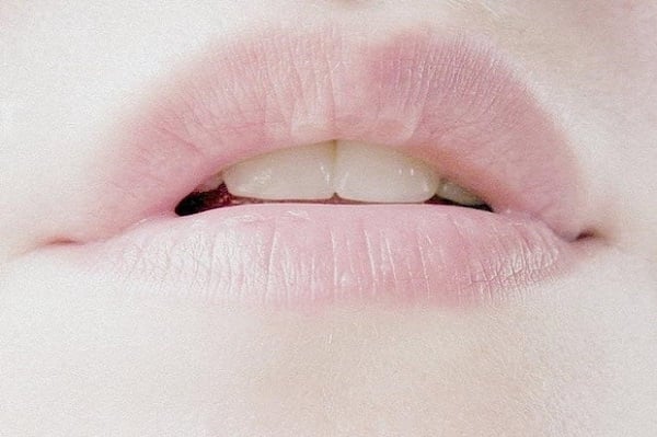  Đôi môi trắng nhợt nhạt là dấu hiệu của việc thiếu máu, thiếu khí...