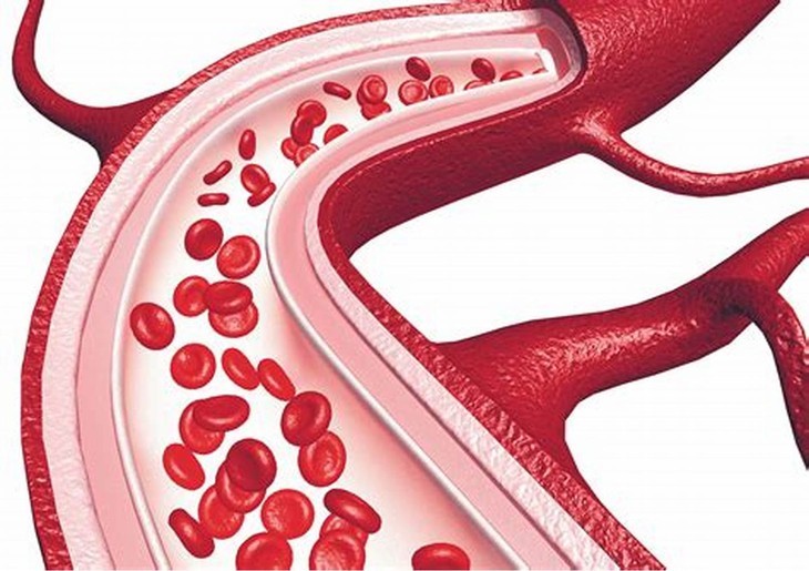  Cục máu đông hình thành trong mạch máu - ảnh minh họa