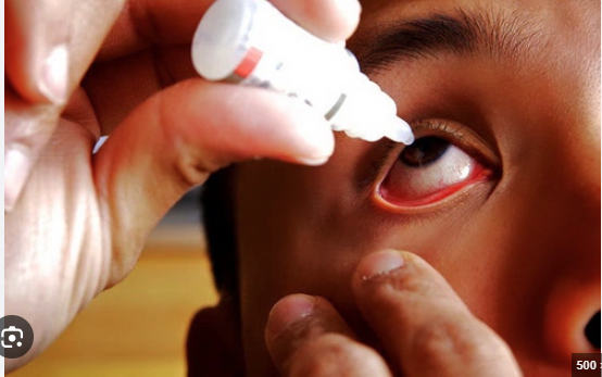  Việc tự mua thuốc nhỏ mắt khi không có kiến thức chuyên môn dễ gây hại cho mắt - Ảnh minh họa