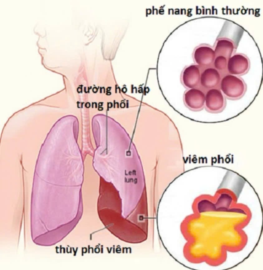 Ảnh minh hoạ/ Nguồn: Internet