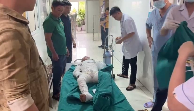 Cháu D. được chẩn đoán bỏng độ III với diện tích 15%, chủ yếu vùng mặt, cẳng cánh tay phải - Ảnh: Báo Công lý