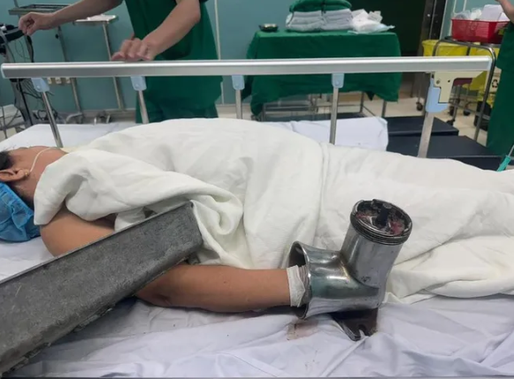 Người phụ nữ làm nghề bán thịt lợn được đưa vào cấp cứu với chiếc máy xay trên tay - Ảnh: VietNamNet