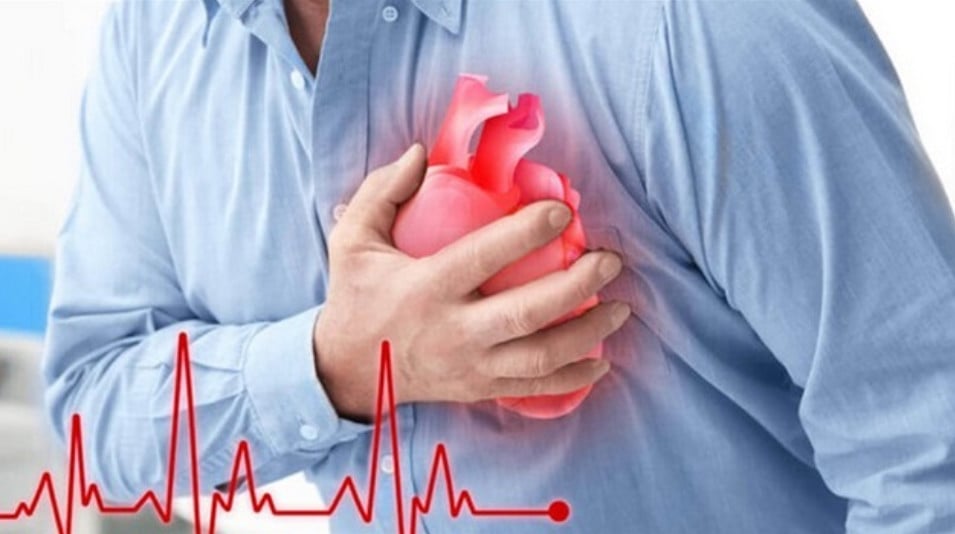 Nhồi máu cơ tim cấp là một trong những nguyên nhân hàng đầu gây tử vong.