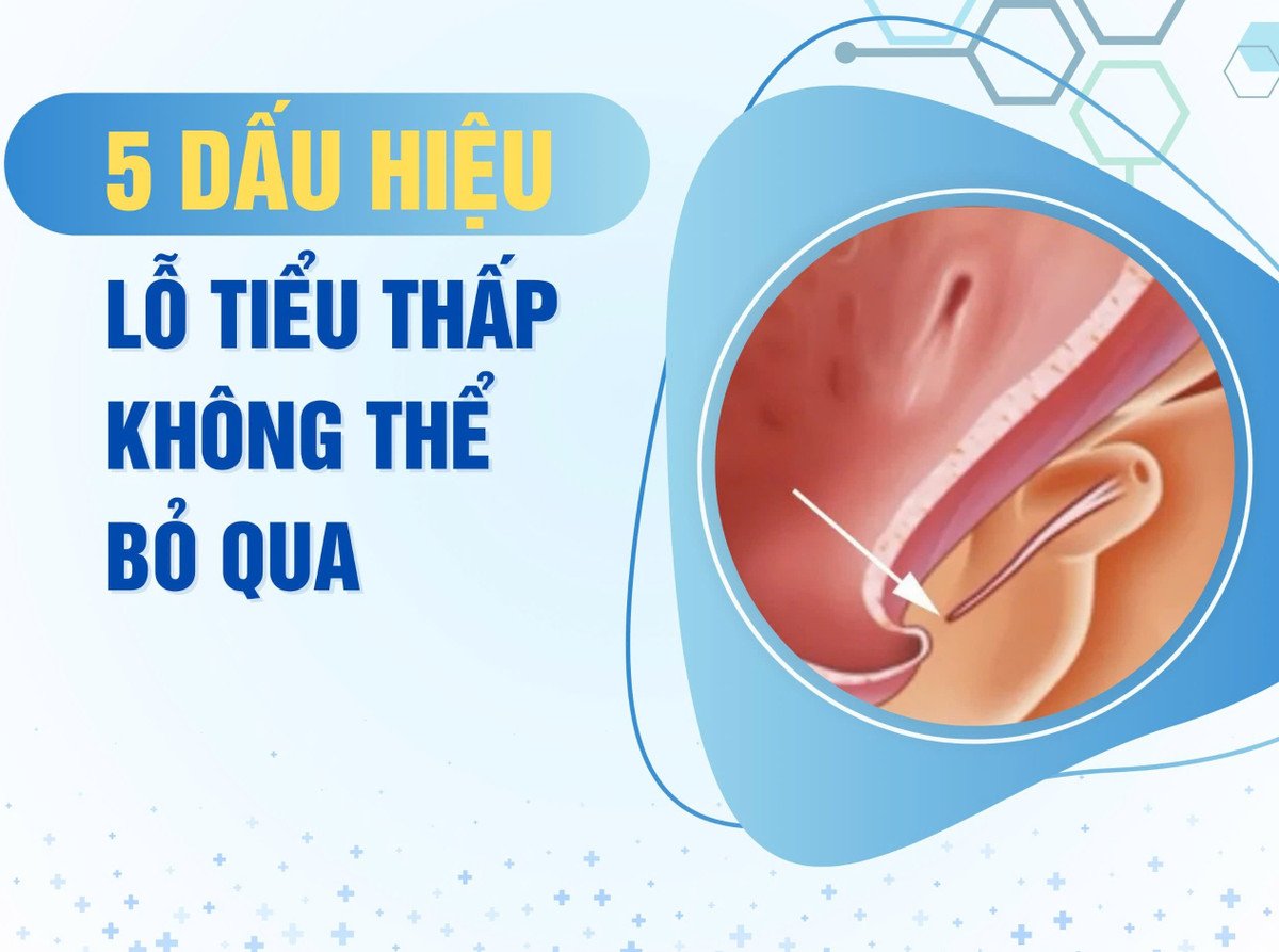 Ảnh minh họa/BV 108