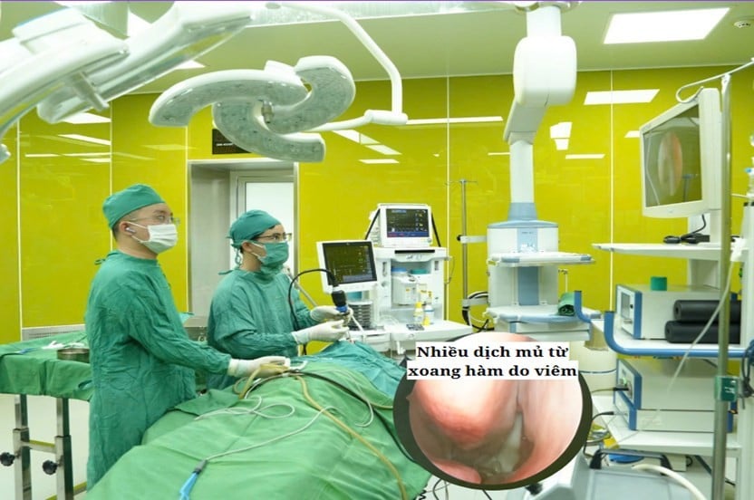 Ca phẫu thuật vẹo vách ngăn mũi cho bệnh nhân - Ảnh BVCC