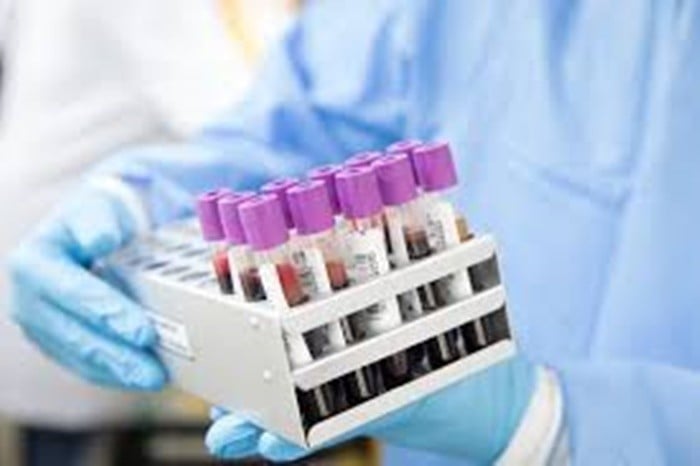 NHS kỳ vọng, từ năm 2026 Galleri có thể được triển khai trên diện rộng sinh thiết lỏng, phát hiện các mảnh nhỏ của ADN chứa ung thư. Ảnh: Getty.