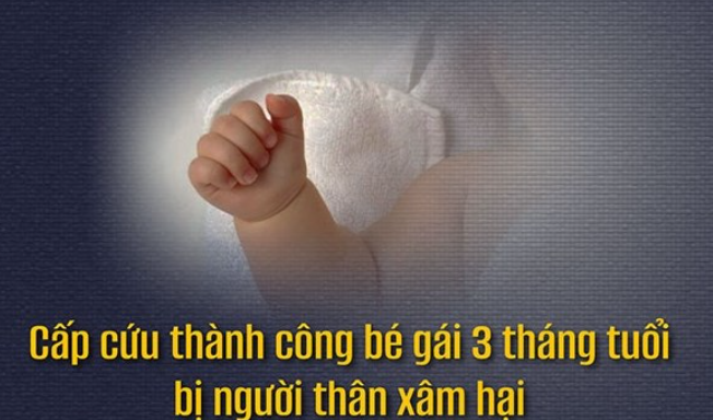  Bệnh viện Nhi Trung ương vừa cấp cứu thành công bé gái 3 tháng tuổi bị người thân xâm hại - Ảnh: Báo Lao Động