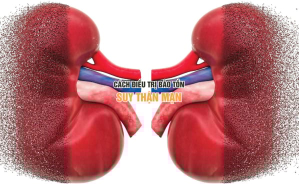 Điều trị bảo tồn suy thận mạn bằng cách kiểm soát triệu chứng bệnh