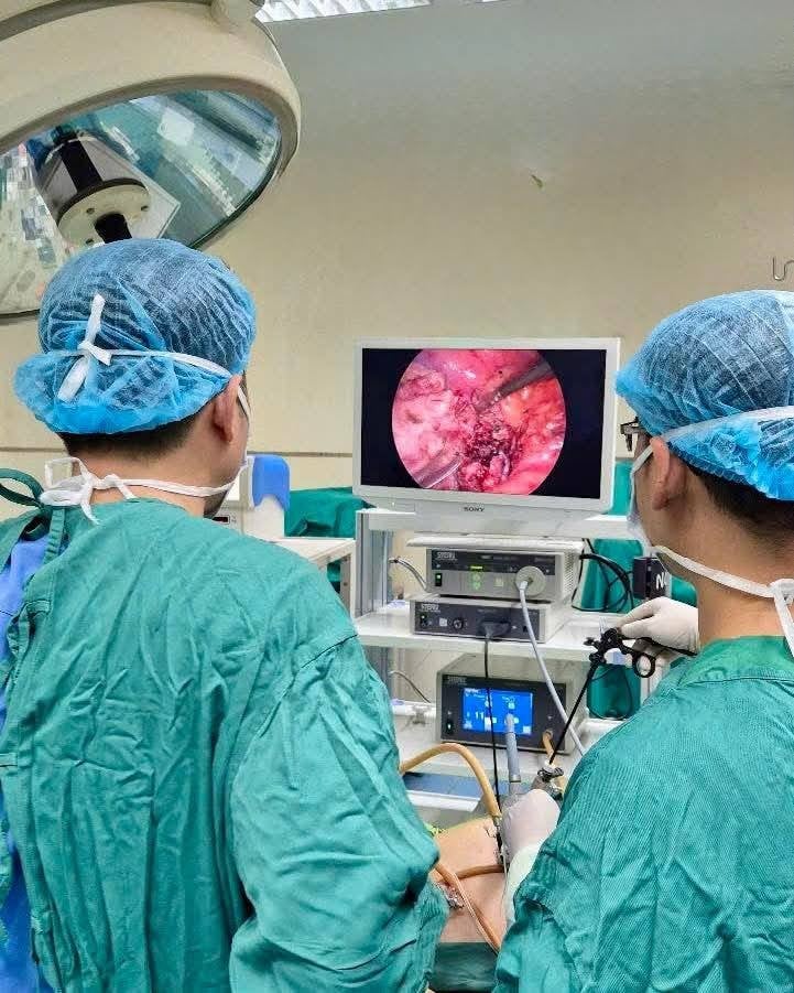 Trong quá trình phẫu thuật nội soi, ê-kíp phát hiện ruột thừa hoại tử nằm quặt ngược phía sau manh tràng - Ảnh Bệnh viện Quân y 4