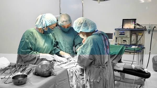 Ca phẫu thuật cắt khối u khủng cho bệnh nhân - Ảnh BVCC