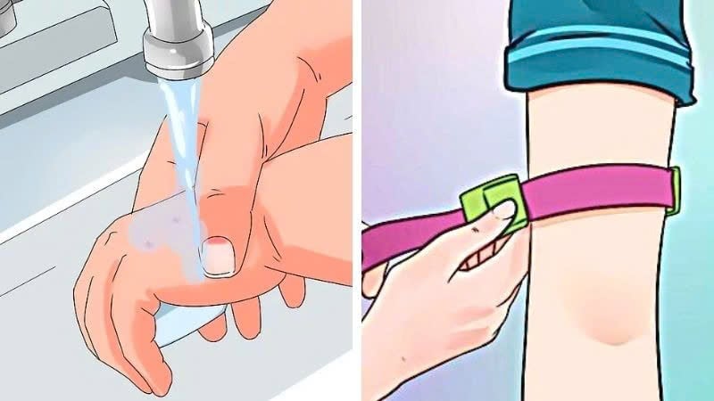 Làm sạch vết thương bằng xà phòng hoặc nước muối sinh lý sau khi bị rắn cắn (Ảnh minh họa).