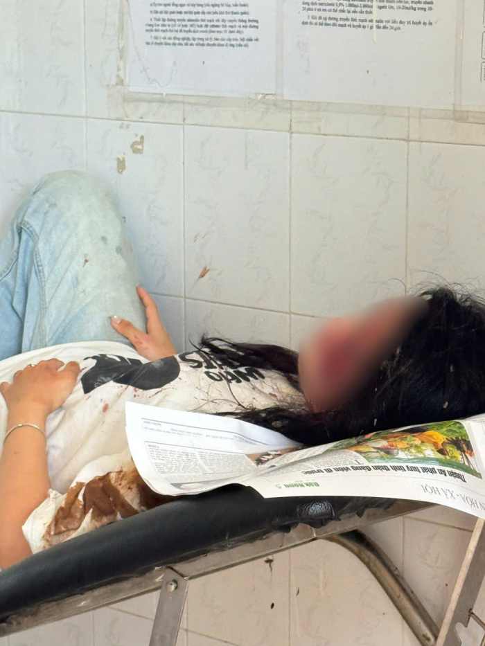5 sinh viên bị thương nhẹ, đã được cứu chữa kịp thời - Ảnh: Báo Lao Động