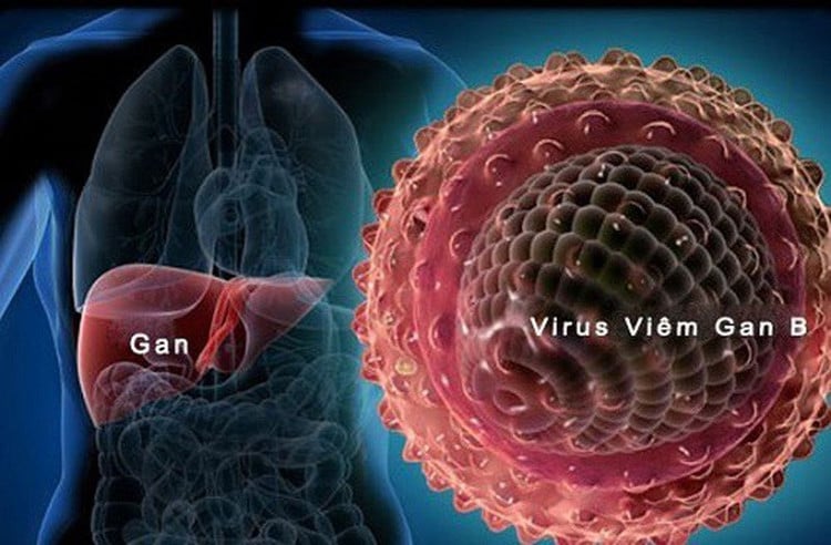  Tải lượng virus viêm gan B - Ảnh BVCC